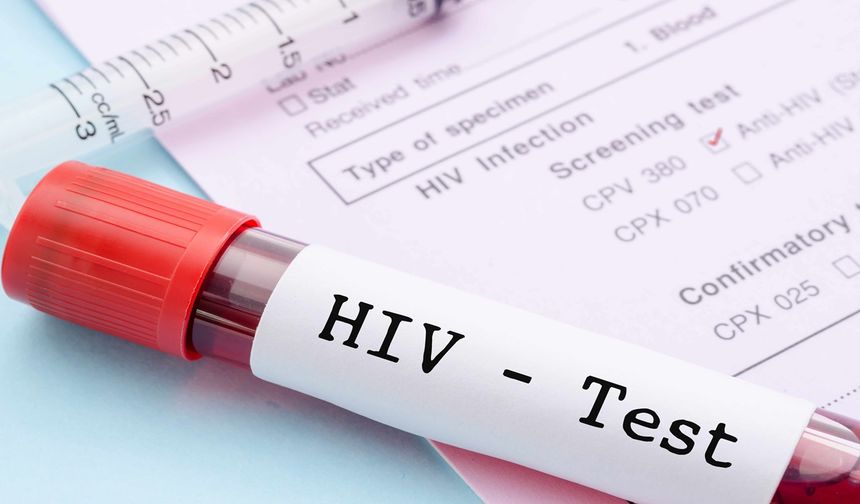 HIV Testi ile Bulaşıcı Hastalıklara Son